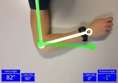 X-Ray Skeletal Tracking